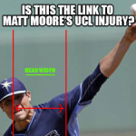 matt-moore-ucl-injury 1